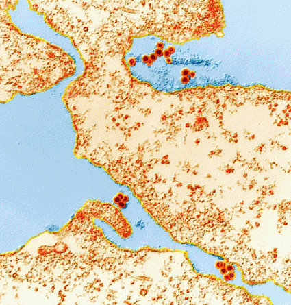 Image: Colored transmission electron micrograph (TEM) of West Nile virus (WNV) particles (red/orange dots) with host cells. The WNV belongs to the group of flaviviruses, and causes encephalitis in humans (Photo courtesy of the Eye of Science).